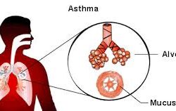 asthma-250x158