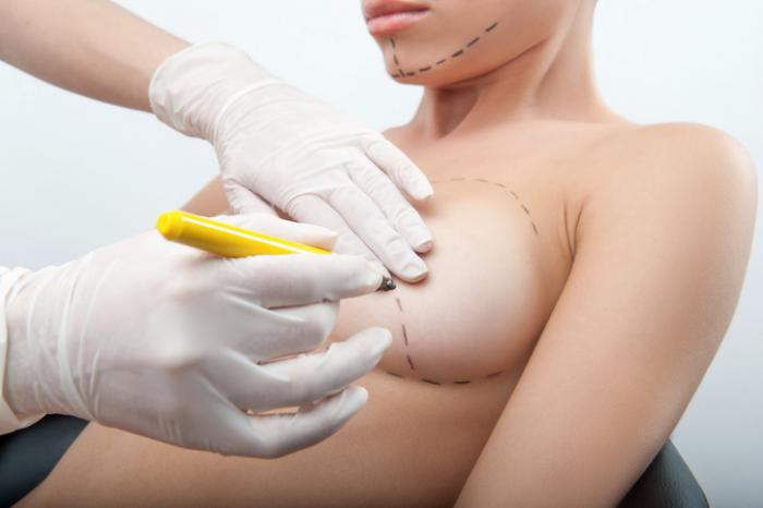 measuring-for-breast-surgery